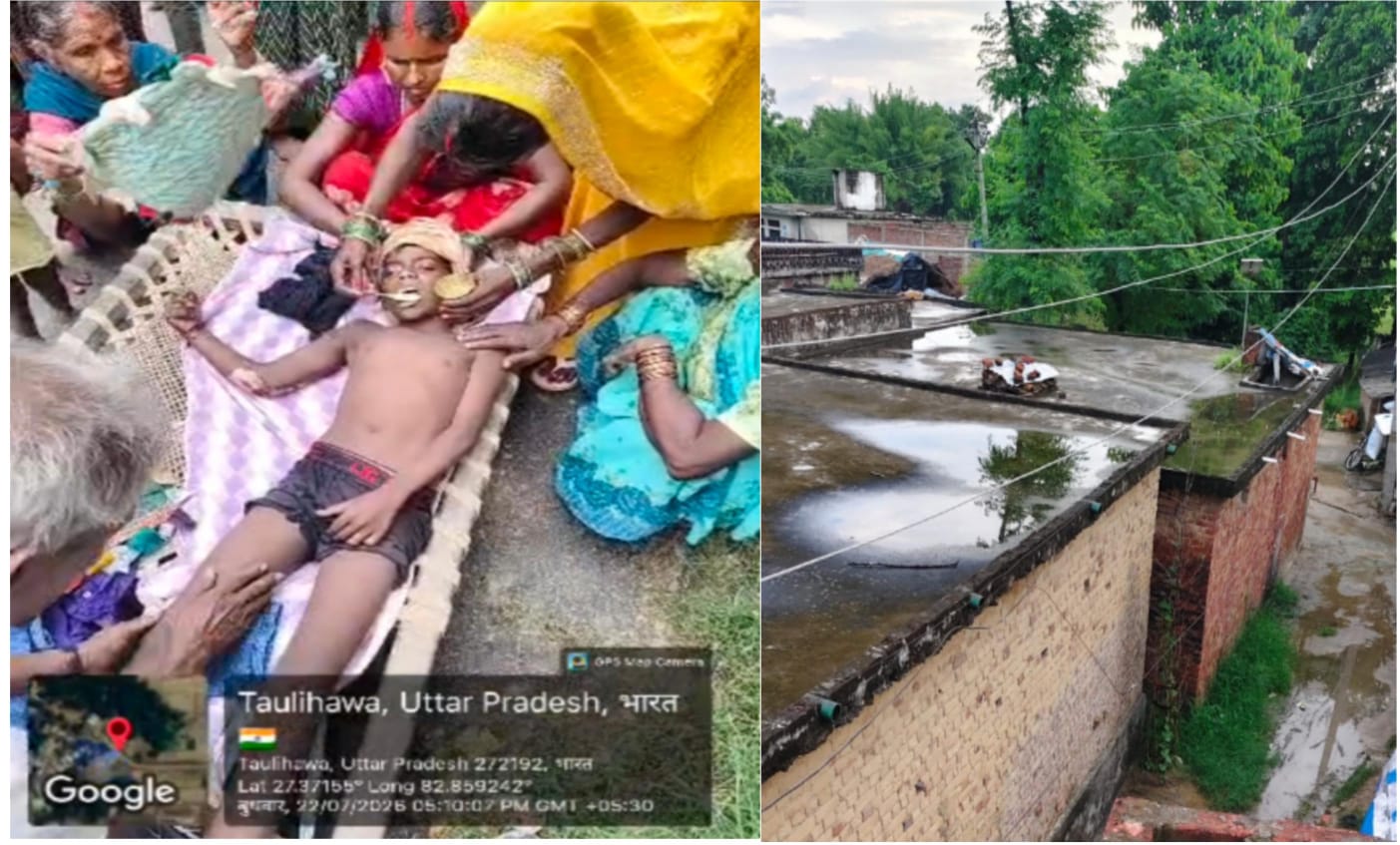 सिस्टम की आपराधिक बेरुखी: 11 हजार वोल्ट के तारों से झुलसे दो मासूम, बदहाल सड़क ने रोका एंबुलेंस का रास्ता