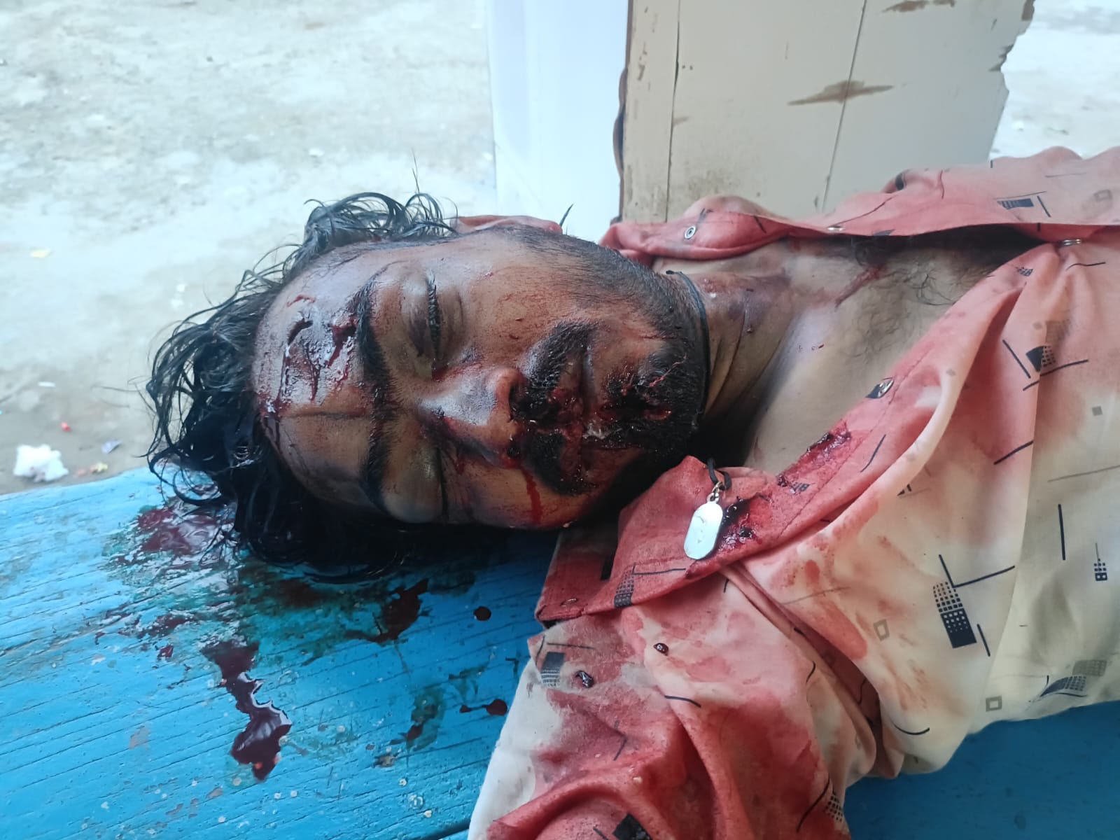 इटवा-ढेबरुआ मार्ग पर खड़े ट्रेलर से टकराई बाइक, 28 वर्षीय युवक की दर्दनाक मौत